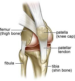 dislodged kneecap